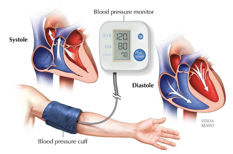 Infographic displaying a blood pressure monitor connected to a blood pressure cuff around an arm.