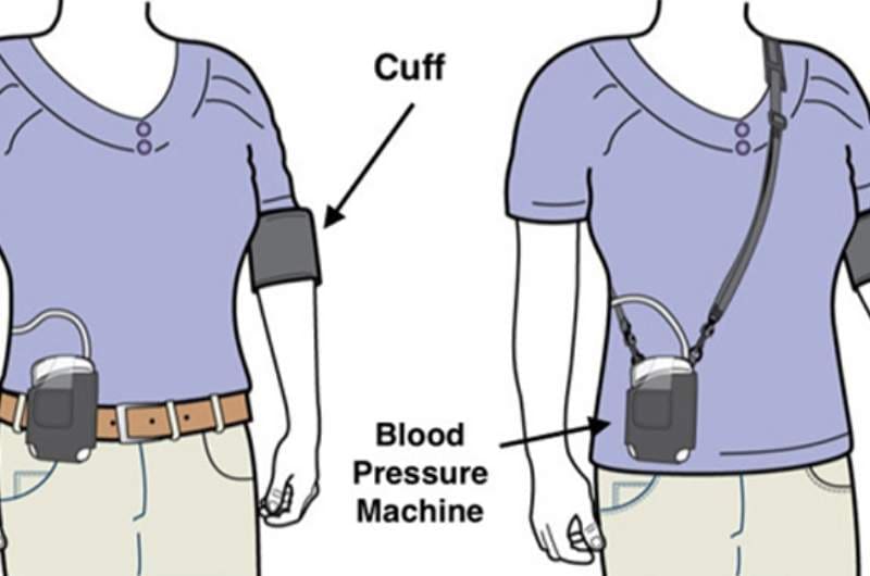 Infographic demonstrating an individual wearing a 24 hour blood pressure machine and the cuff around their arm. Appointments available at Narangba Station Medical Centre.