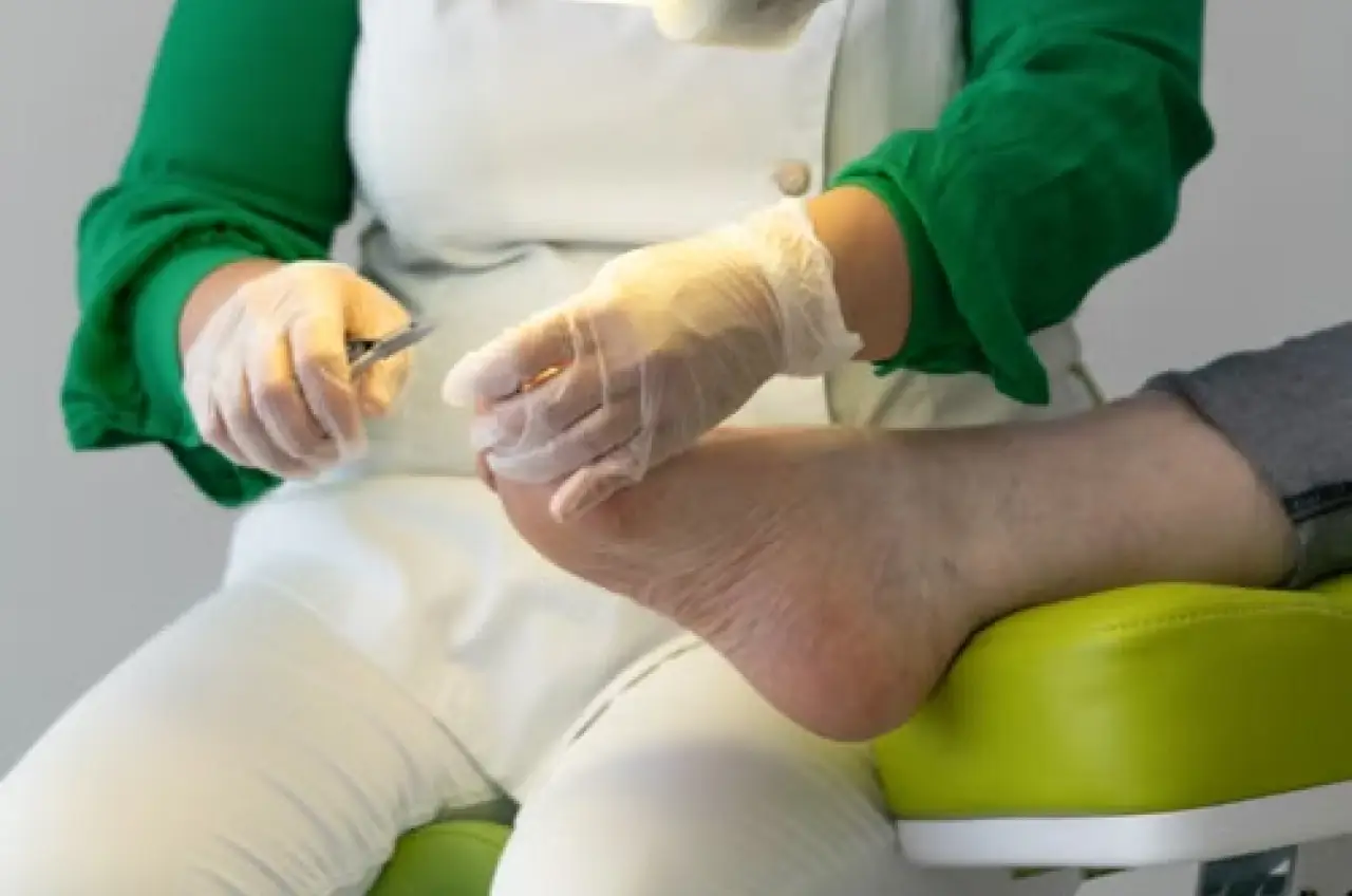Ingrown Toenail Assessment & Removal